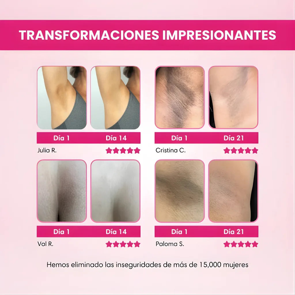 SkinGlow™ | Crema Corporal Aclarante